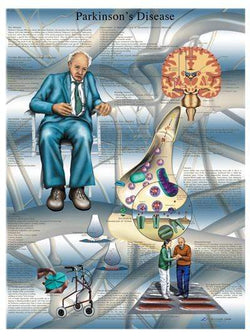 3B Anatomical Chart - Parkinson's Disease- laminated  20x26''